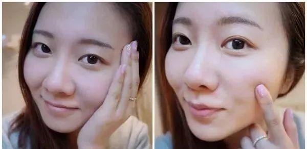 美白针的功效与副作用，深入了解美白产品的作用与潜在风险，美白针的功效与潜在风险，全面了解美白产品的功效与副作用
