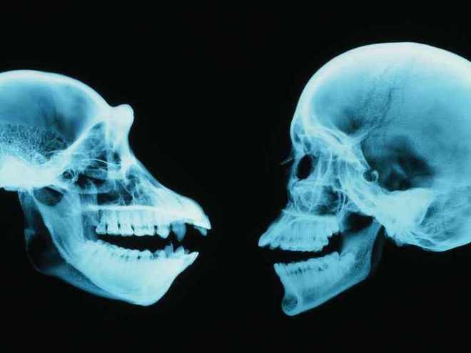 大猩猩的睾丸与人类的睾丸,生物学视角下的比较与探讨,大猩猩与人类睾丸的生物学比较与探讨