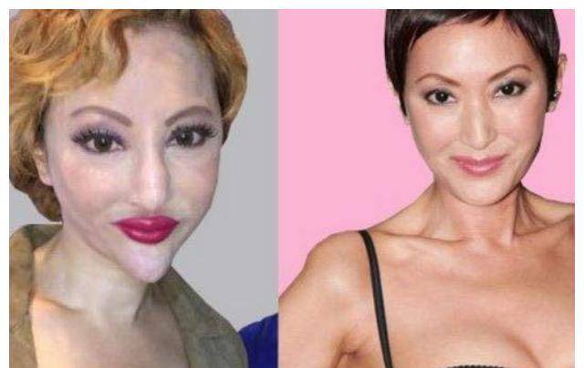 港台明星整容失败,探究背后的原因与教训,港台明星整容失败背后的原因与教训探究