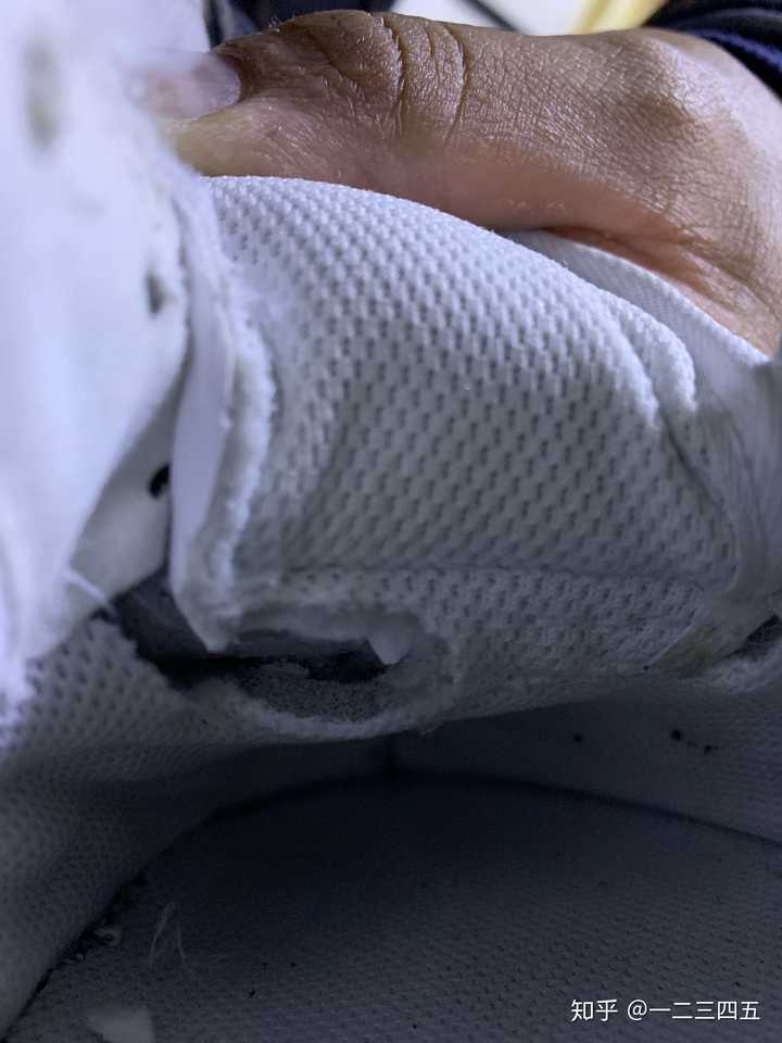 空军一号折痕引起的脚部疼痛解决方案，空军一号折痕导致的脚部疼痛缓解方案探讨